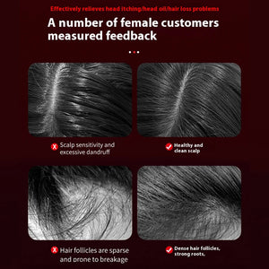 Scalp Massage Comb Sleekify